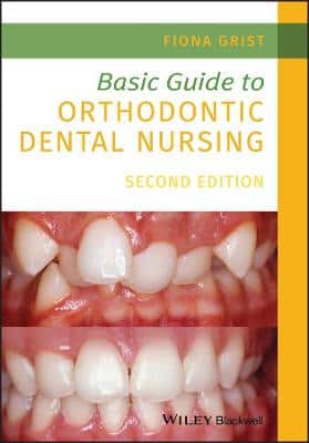 BASIC GUIDE TO ORTHODONTIC DENTAL NURSIN
